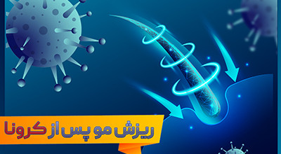 ریزش مو پس از کرونا